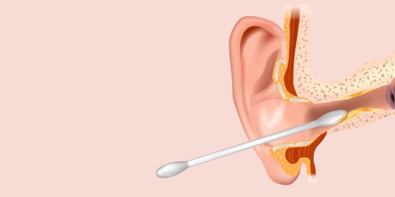 The problems of having excess Earwax